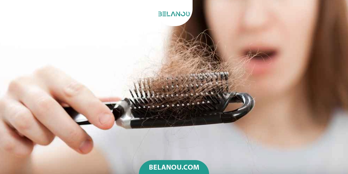 سن شروع ریزش مو ارثی و هورمونی 