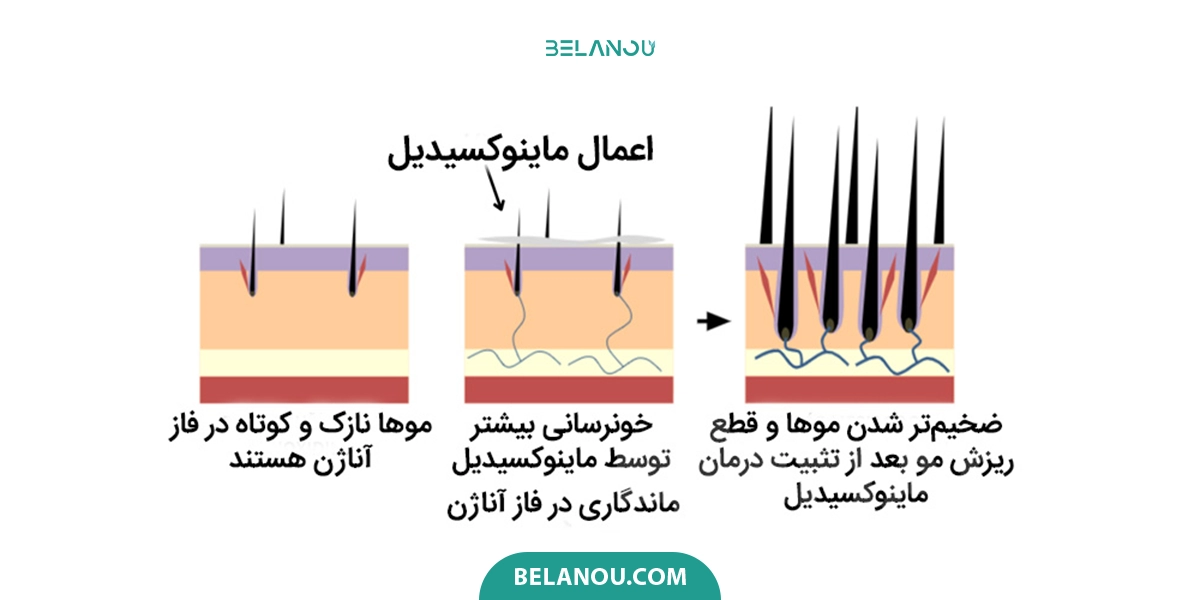 نحوه عملکرد ماینوکسیدیل