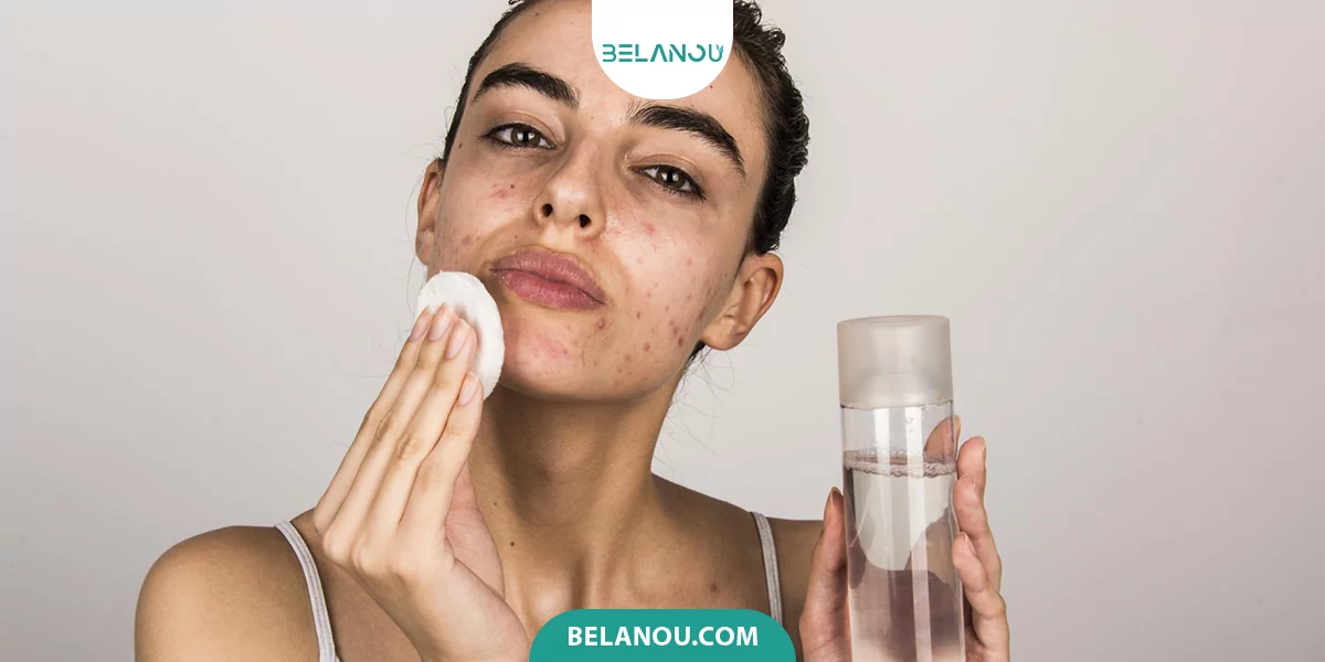 روتین پوستی برای پوست چرب و اکنه دار