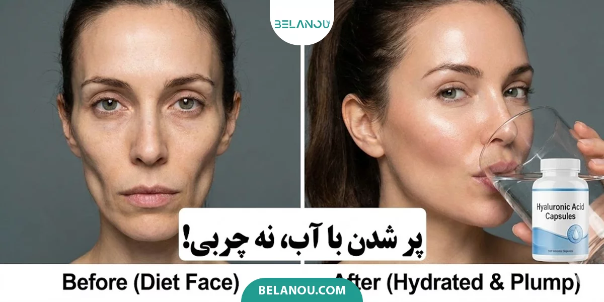 قرص هیالورونیک اسید برای پوست و چاقی صورت