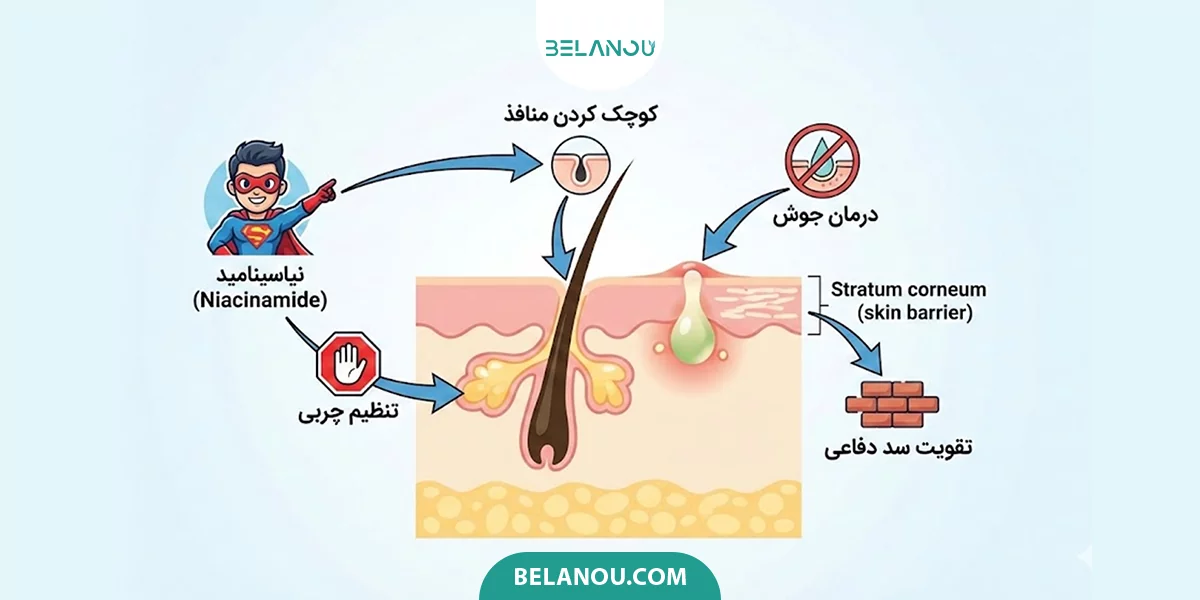 نیاسینامید و هیالورونیک برای درمان منافذ پوست