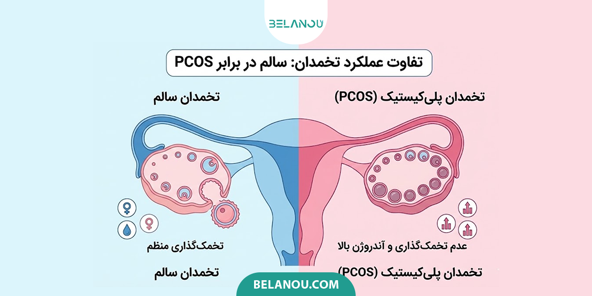 بررسی تفاوت عملکرد تخمدان تنبل و تخمدان سالم
